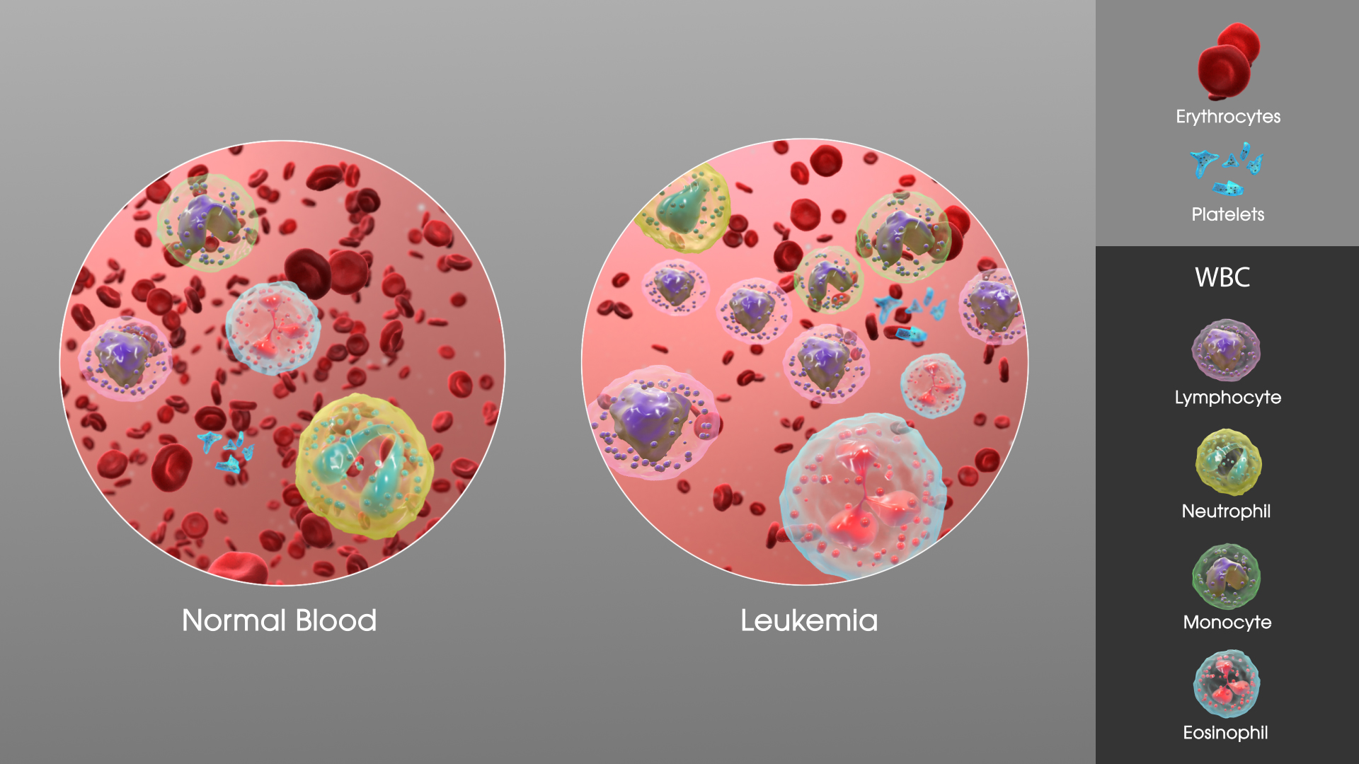 leuk-mie-haematologie-onkologie-2013-at